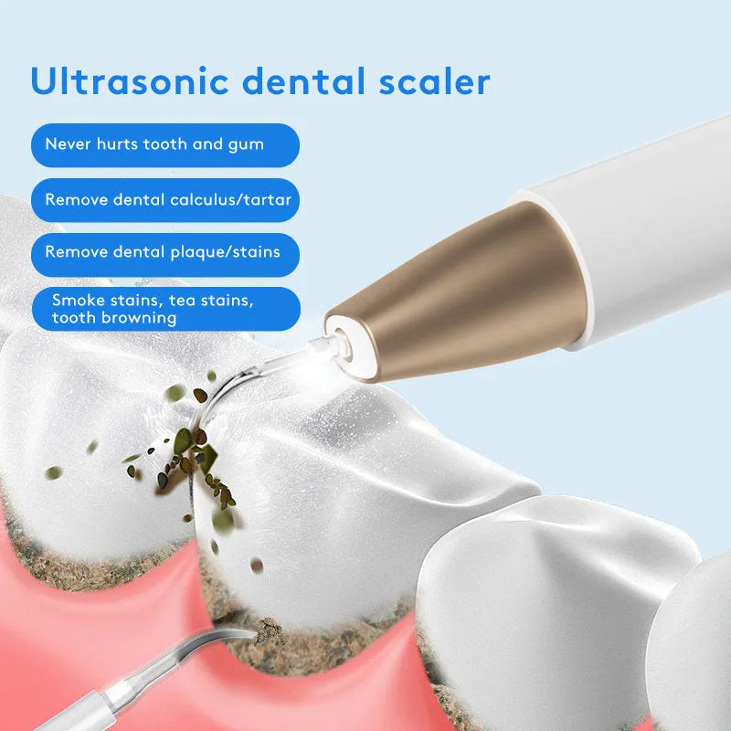 Gold-handled ultrasonic tooth cleaner with stainless steel tips for removing tartar and stains.