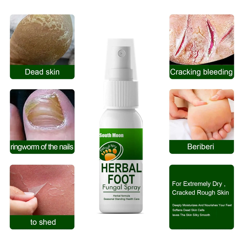 30ml foot nourishing hydrating spray bottle for dry feet treatment