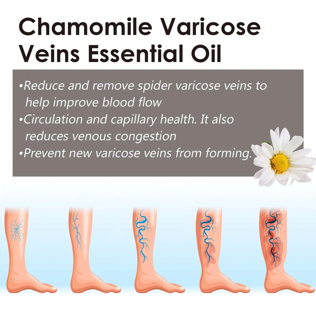 10ml chamomile leg essential oil bottle for leg massage and discomfort relief