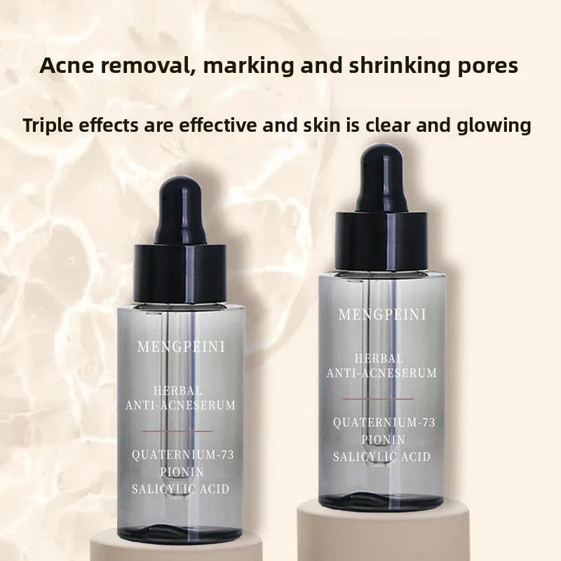 Anti-acne facial essence 30ml box set for closed acne treatment