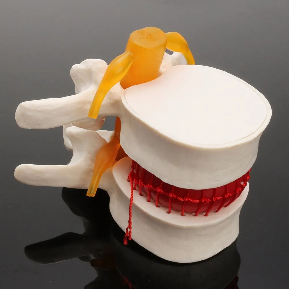 White PVC lumbar intervertebral disc demonstration model showing anatomical details