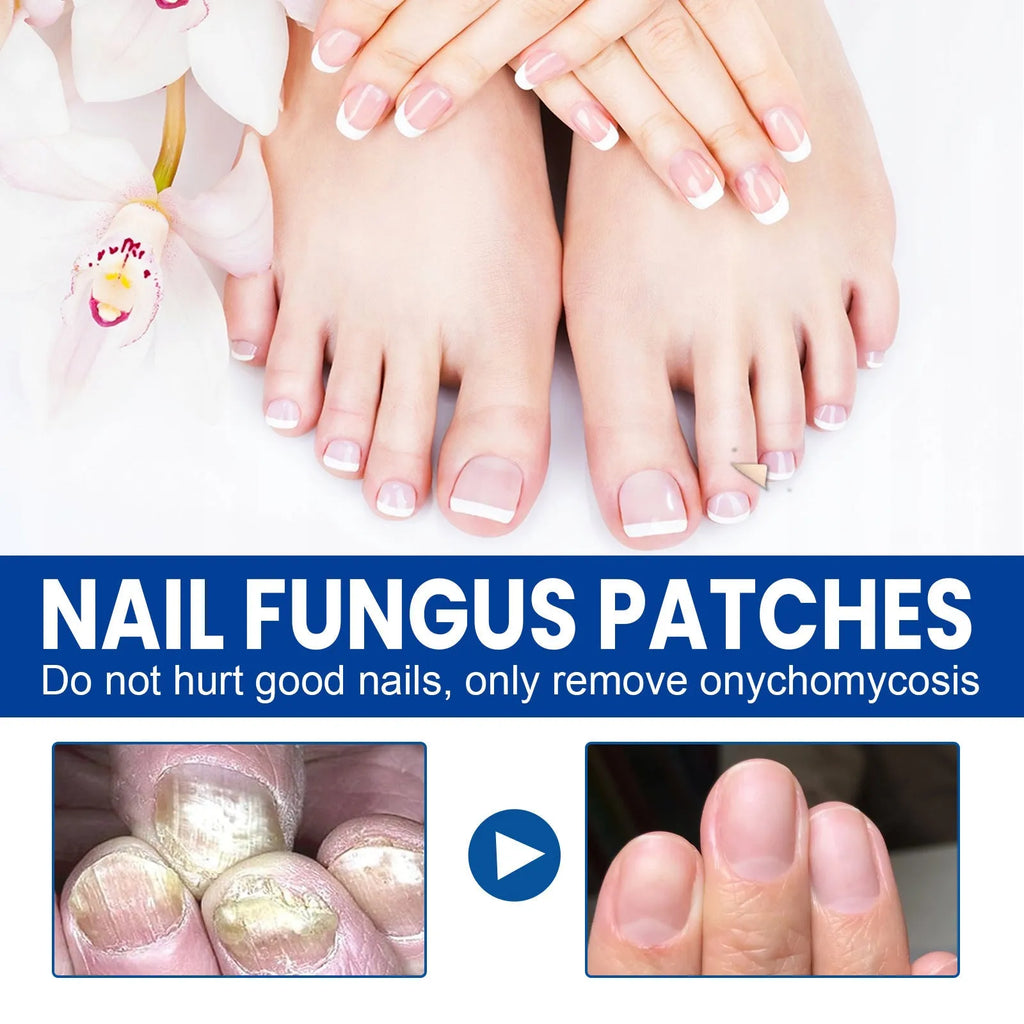 Box of 32 nail repair adhesive bandage patches for cracked nails, shown with one patch removed.