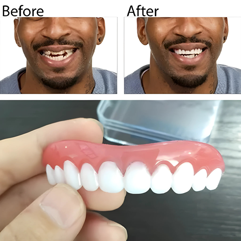 Removable cosmetic veneers for smile makeover, resizable to fit gapped and missing teeth