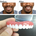 Removable cosmetic veneers for smile makeover, resizable to fit gapped and missing teeth
