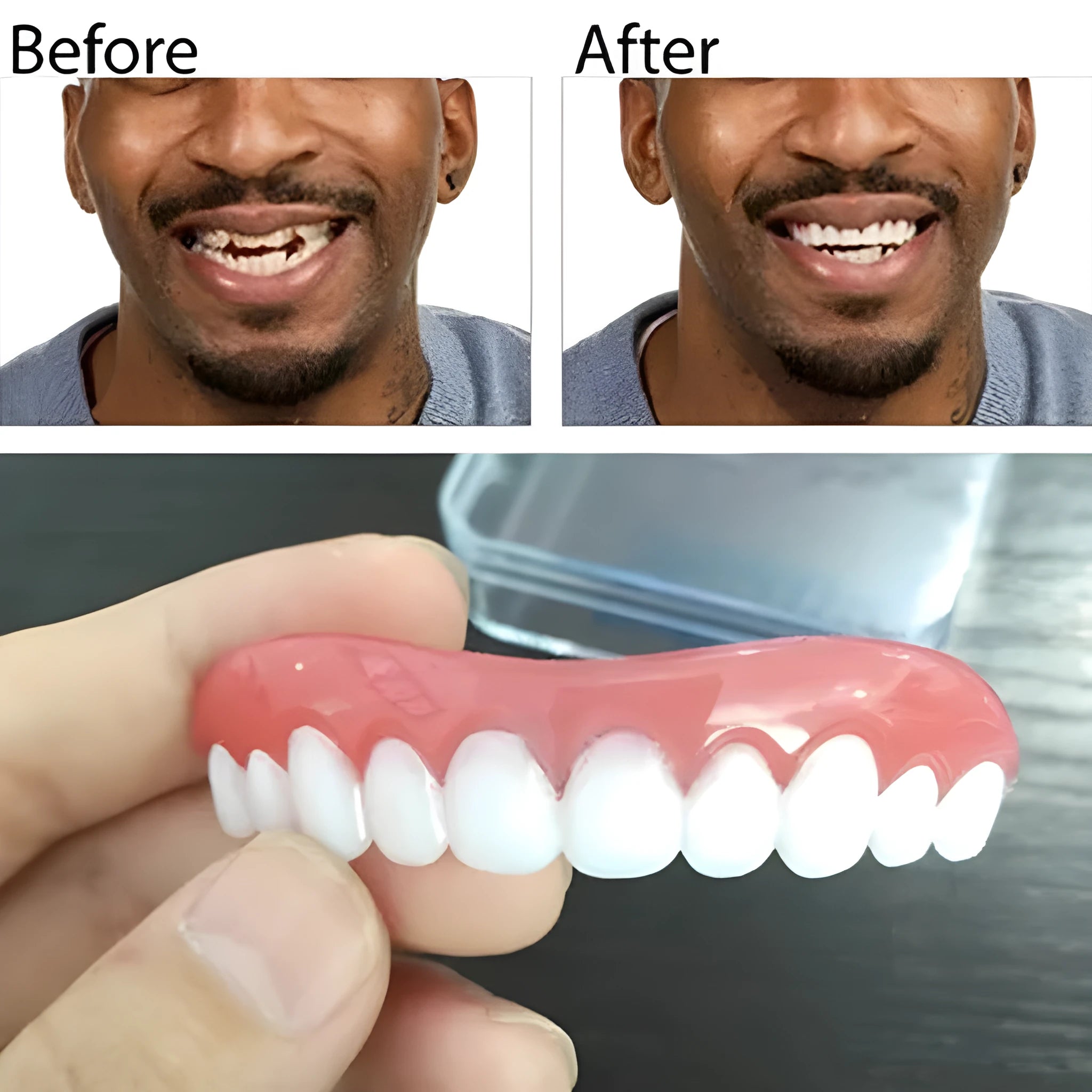 Removable cosmetic veneers for smile makeover, resizable to fit gapped and missing teeth