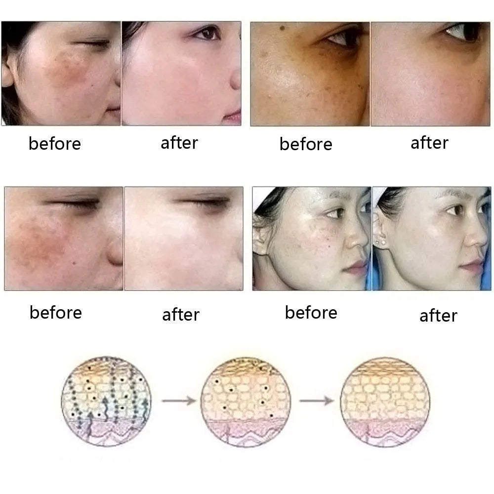 Dredge Meridian Skin Care Essence Oil 10ml bottle for dark spot and scar removal