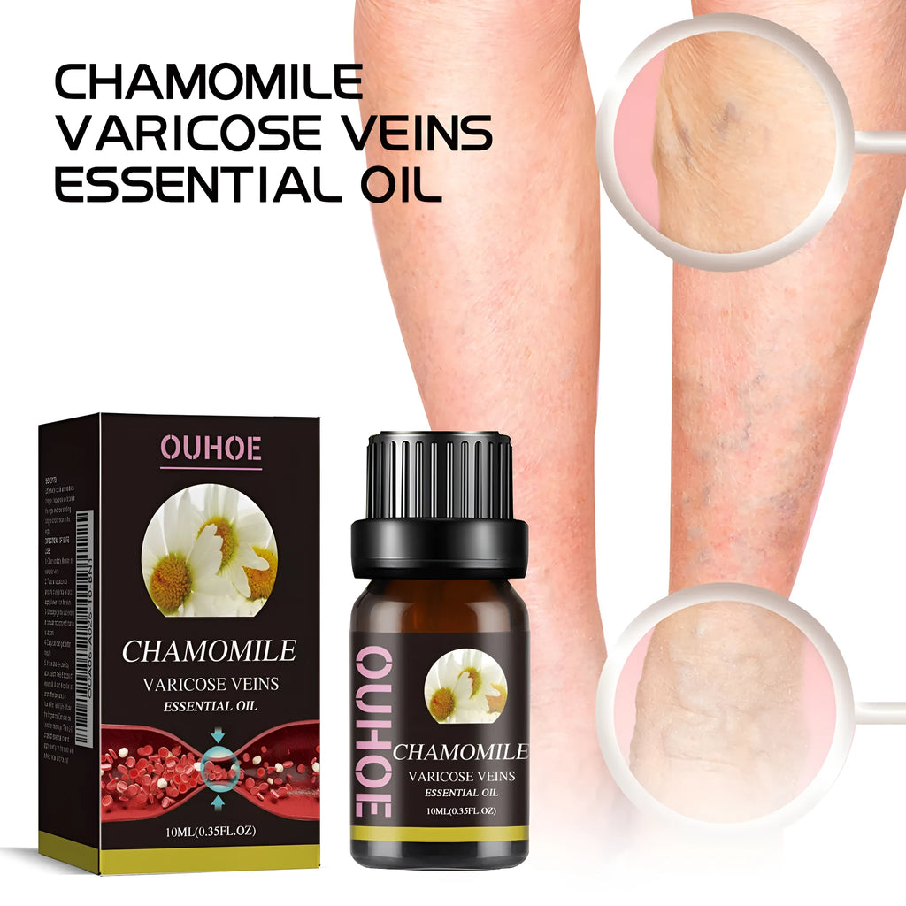 10ml chamomile leg essential oil bottle for leg massage and discomfort relief