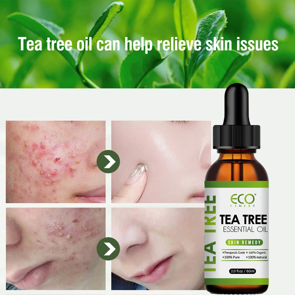 Tea tree oil essential oil bottle 60ml for acne skincare and massage applications