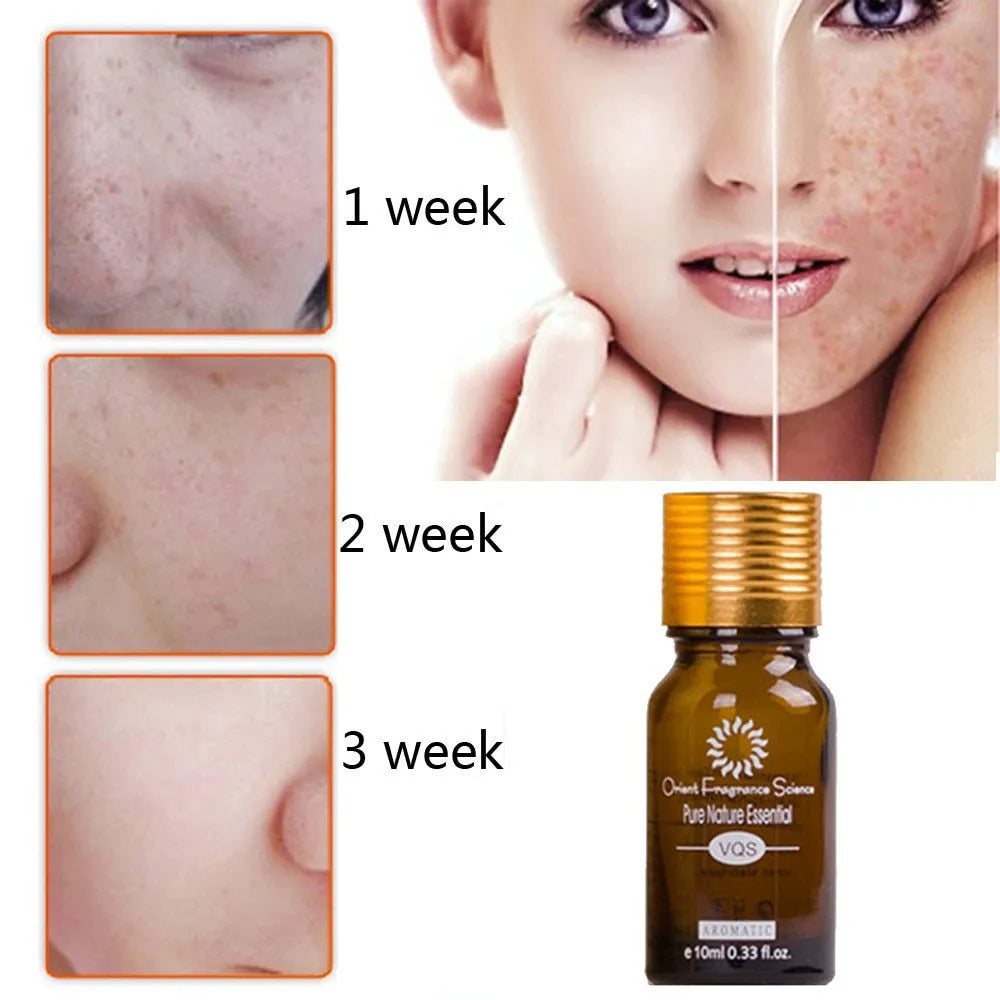 Dredge Meridian Skin Care Essence Oil 10ml bottle for dark spot and scar removal