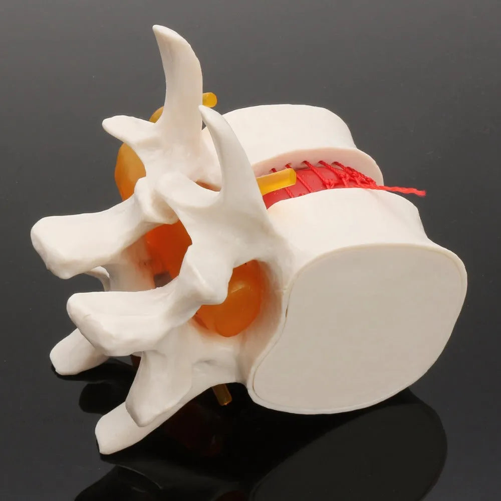 White PVC lumbar intervertebral disc demonstration model showing anatomical details