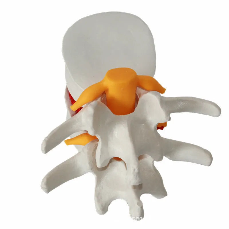 White PVC lumbar intervertebral disc demonstration model showing anatomical details