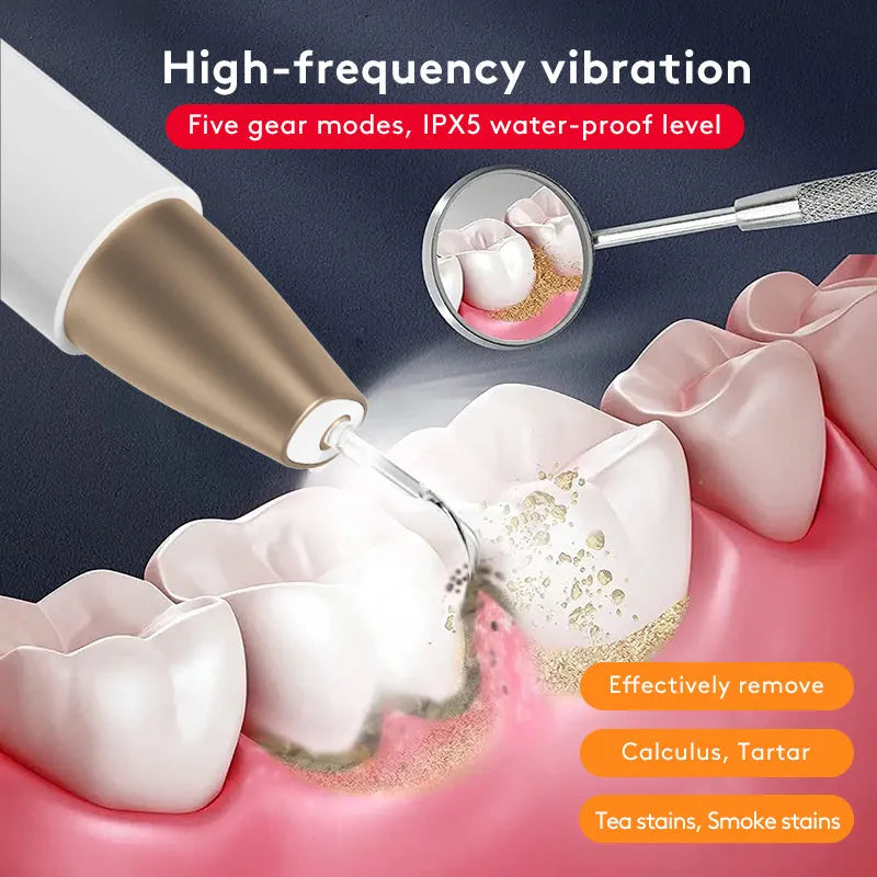 Gold-handled ultrasonic tooth cleaner with stainless steel tips for removing tartar and stains.