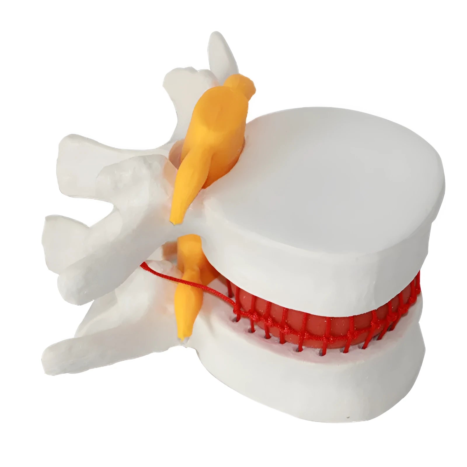 White PVC lumbar intervertebral disc demonstration model showing anatomical details