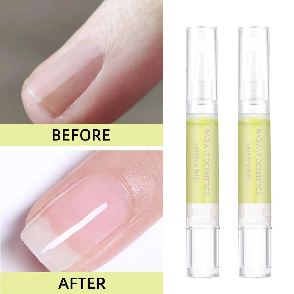 3ml bottle of wash-free nail growth treatment oil for moisturising and promoting natural nail growth