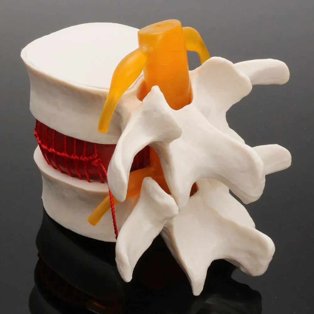 White PVC lumbar intervertebral disc demonstration model showing anatomical details