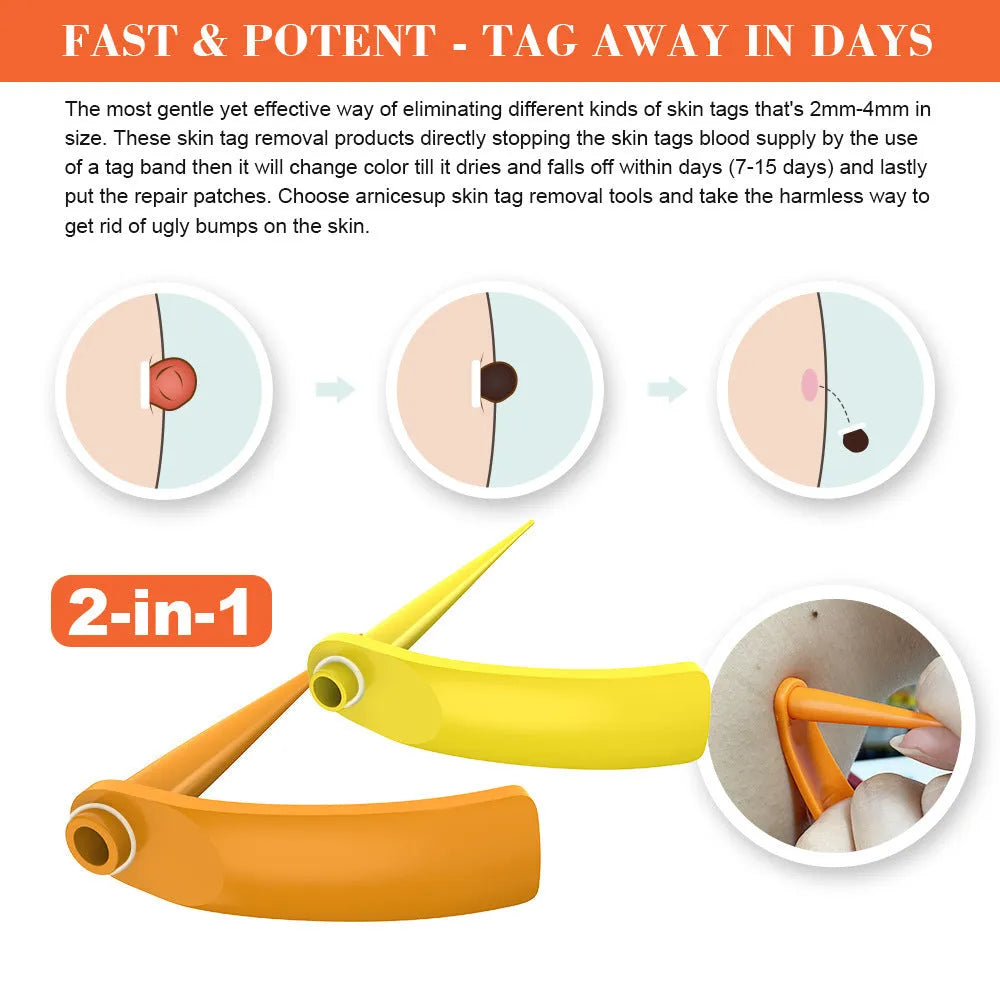 Orange-yellow mole remover tool kit with two devices, rubber rings, alcohol swabs and repair sticker