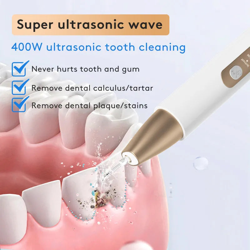Gold-handled ultrasonic tooth cleaner with stainless steel tips for removing tartar and stains.