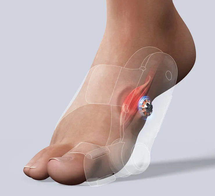 White plastic electric adjustable hallux valgus toe separator with silicone gel pad and Type-C charging port.