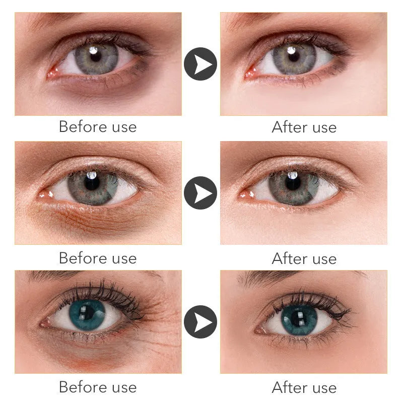 30ml container of Beauty Eye Cream for women's skincare