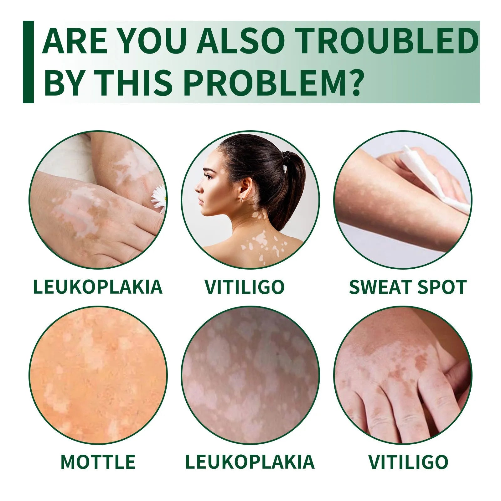 35g body cream for orange peel skin treatment with cleansing and moisturising properties