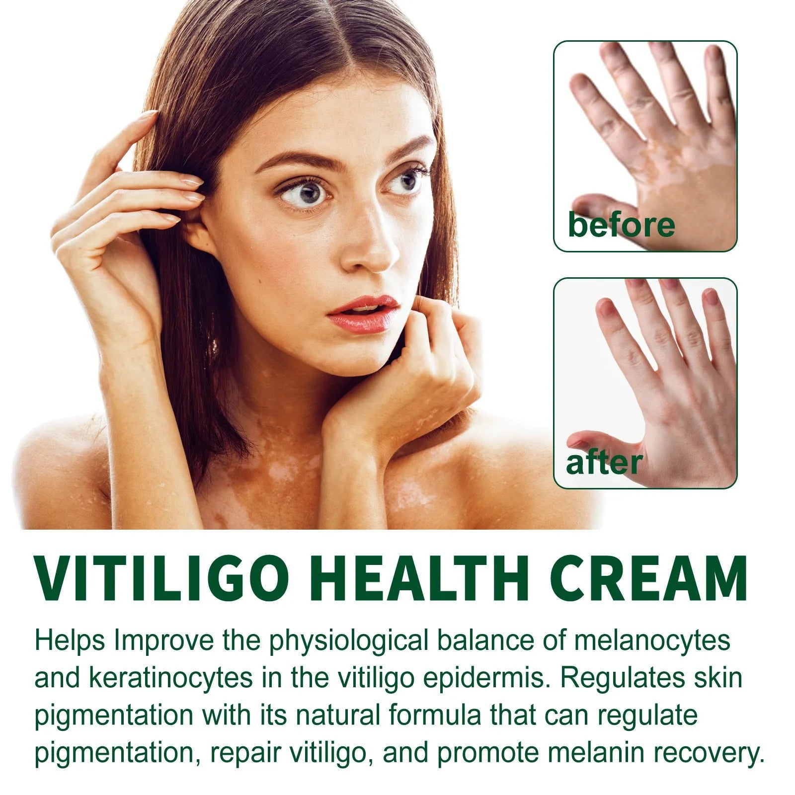 35g body cream for orange peel skin treatment with cleansing and moisturising properties
