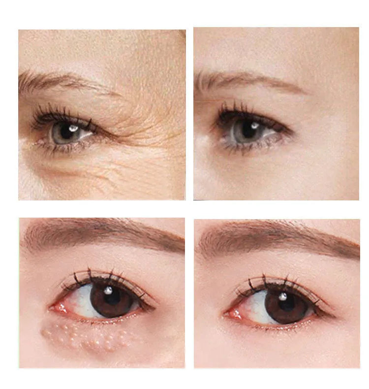 30ml container of Beauty Eye Cream for women's skincare