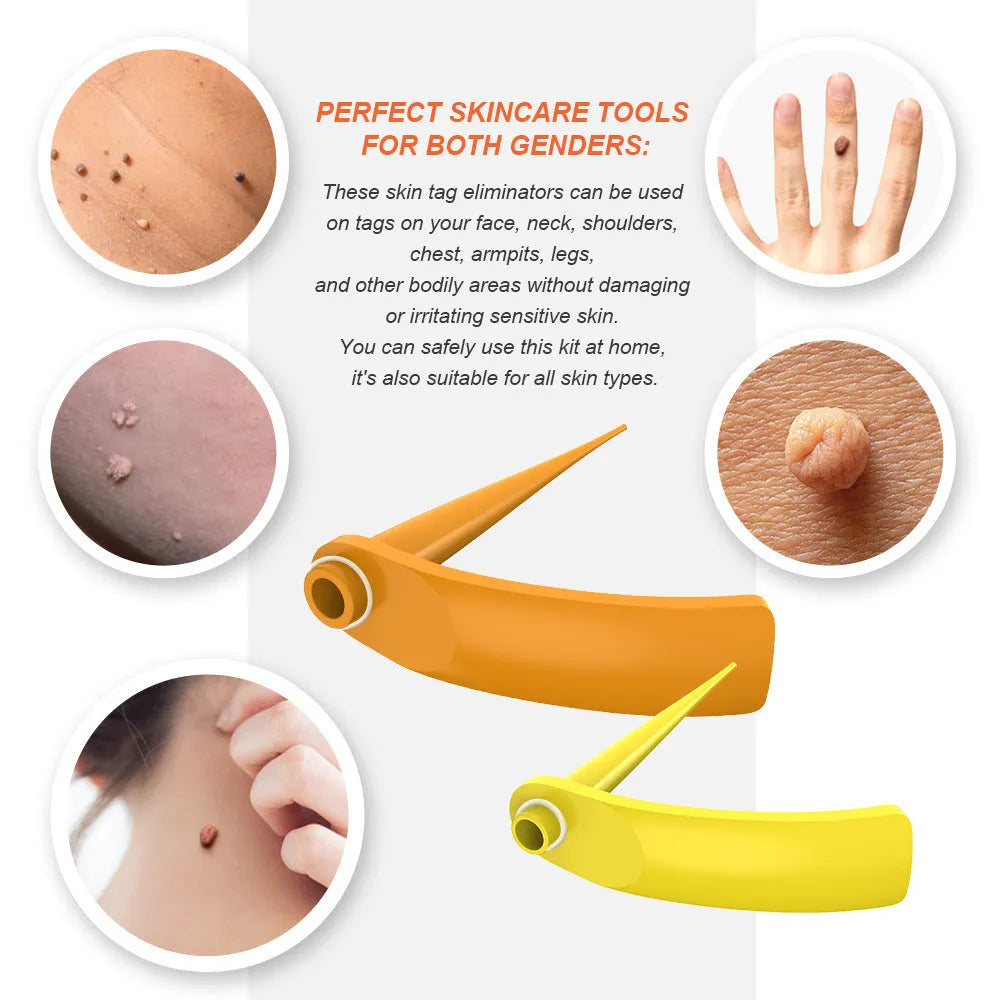 Orange-yellow mole remover tool kit with two devices, rubber rings, alcohol swabs and repair sticker