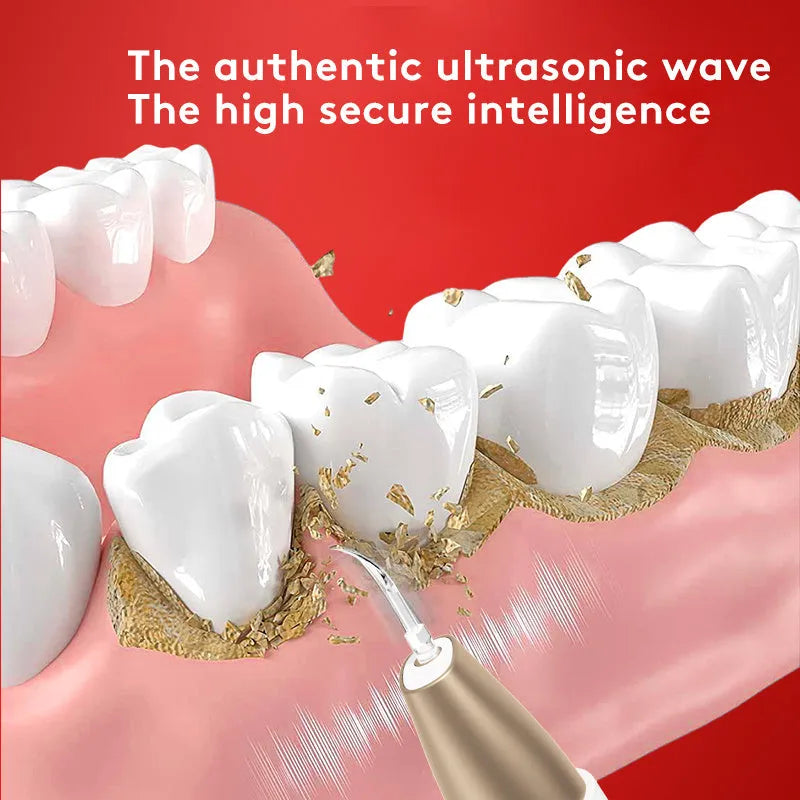 Gold-handled ultrasonic tooth cleaner with stainless steel tips for removing tartar and stains.